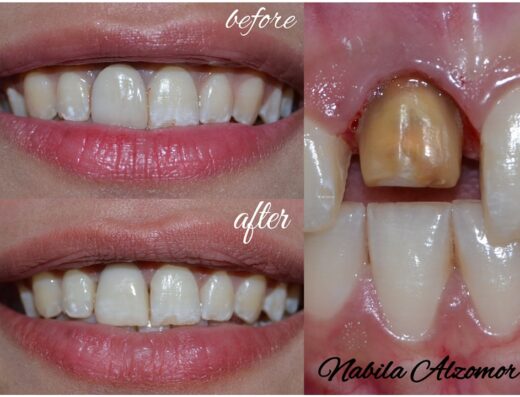 Dr. Nabila Elzomor Dental Clinic 