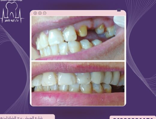 عيادات أثليت لطب الاسنان دكتورة اية ناصر
