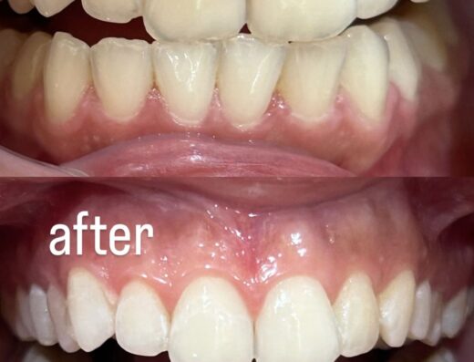 I Smile – لعيادات الاسنان